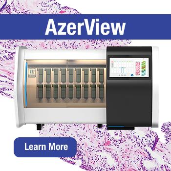 AzerView LH510