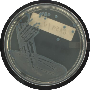 Chromogenic URINE medias